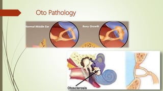Oto Pathology
 