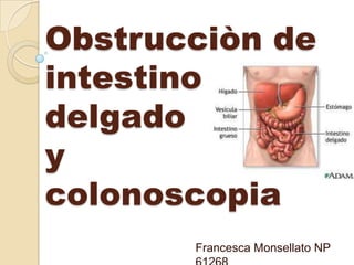 Obstrucciòn de
intestino
delgado
y
colonoscopia
       Francesca Monsellato NP
 