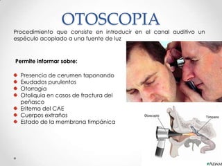 OTOSCOPIA

Procedimiento que consiste en introducir en el canal auditivo un
espéculo acoplado a una fuente de luz

Permite informar sobre:
Presencia de cerumen taponando
Exudados purulentos
Otorragia
Otoliquia en casos de fractura del
peñasco
Eritema del CAE
Cuerpos extraños
Estado de la membrana timpánica

 