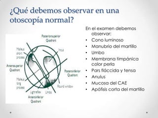 ¿Qué debemos observar en una
otoscopía normal?
En el examen debemos
observar:
• Cono luminoso
• Manubrio del martillo
• Umbo
• Membrana timpánica
color perla
• Pars fláccida y tensa
• Anulus
• Mucosa del CAE
• Apófisis corta del martillo

 
