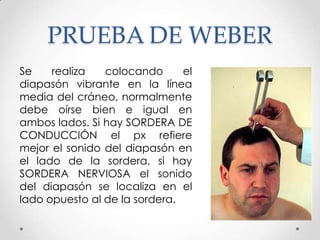 PRUEBA DE WEBER
Se
realiza
colocando
el
diapasón vibrante en la línea
media del cráneo, normalmente
debe oírse bien e igual en
ambos lados. Si hay SORDERA DE
CONDUCCIÓN el px refiere
mejor el sonido del diapasón en
el lado de la sordera, si hay
SORDERA NERVIOSA el sonido
del diapasón se localiza en el
lado opuesto al de la sordera.

 