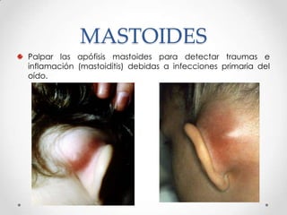 MASTOIDES
Palpar las apófisis mastoides para detectar traumas e
inflamación (mastoiditis) debidas a infecciones primaria del
oído.

 
