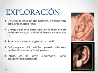 EXPLORACIÓN
Observar la posición del pabellón: Posición más
baja, Enfermedad renal
El origen del hélix debe estar en la misma línea
horizontal en que se sitúa el ángulo externo del
ojo.
Se asocia sordera congénita con nefritis
Piel delgada del pabellón permite observar
fácilmente cianosis y tofos gotosos
Lóbulo
de
la
oreja
característico de la lepra

engrosado,

signo

 