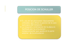 POSICION DE SCHULLER
 Es una de las posiciones clasicamente
utilizadas que ofrece la posion de la cara
quirurgica del temporal.
 La situacion y orientacion de la placa es
facilitada por la articulacion
temporomaxilar que queda en la parte
anterior de la articulacion
 