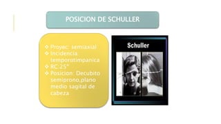 POSICION DE SCHULLER
 Proyec: semiaxial
 Incidencia:
temporotimpanica
 RC:25º
 Posicion: Decubito
semiprono,plano
medio sagital de
cabeza
 