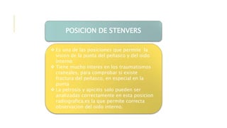 POSICION DE STENVERS
 Es una de las posiciones que permite la
vision de la punta del peñasco y del oido
interno
 Tiene mucho interes en los traumatismos
craneales, para comprobar si existe
fractura del peñasco, en especial en la
punta
 La petrosis y apicitis solo pueden ser
analizadas correctamente en esta posicion
radiografica,es la que permite correcta
observacion del oido interno.
 