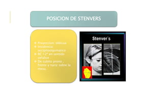 POSICION DE STENVERS
 Proyeccion: oblicua
 Incidencia:
occipitosigomatico
 RC:12º en sentido
cefalico
 De cubito prono ,
frente y nariz sobre la
mesa.
 