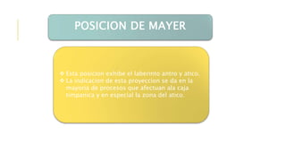 POSICION DE MAYER
 Esta posicion exhibe el laberinto antro y atico.
 La indicacion de esta proyeccion se da en la
mayoria de procesos que afectuan ala caja
timpanica y en especial la zona del atico.
 