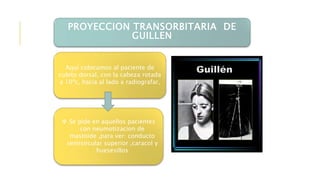 PROYECCION TRANSORBITARIA DE
GUILLEN
 Se pide en aquellos pacientes
con neumotizacion de
mastoide ,para ver: conducto
semisircular superior ,caracol y
huesesillos
Aquí colocamos al paciente de
cubito dorsal, con la cabeza rotada
a 10ºc, hacia al lado a radiografar,
 