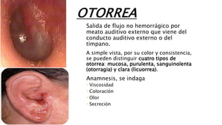 OTORREA
Salida de flujo no hemorrágico por
meato auditivo externo que viene del
conducto auditivo externo o del
tímpano.
A simple vista, por su color y consistencia,
se pueden distinguir cuatro tipos de
otorrea: mucosa, purulenta, sanguinolenta
(otorragia) y clara (licuorrea).
Anamnesis, se indaga
 Viscosidad
 Coloración
 Olor
 Secreción
 