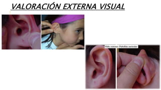 VALORACIÓN EXTERNA VISUAL
 