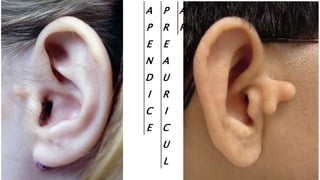 A
P
E
N
D
I
C
E
P
R
E
A
U
R
I
C
U
L
A
R
 