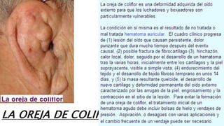 LA OREJA DE COLIFLOR
 