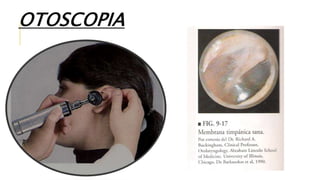 OTOSCOPIA
 