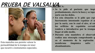 Esta maniobra nos permite valorar la
permeabilidad de la trompa sin tener
que recurrir a instrumentos especiales.
TECNICA:
 Se le pide al paciente que inspi
profundamente, cierre la boca y se tape
nariz con los dedos.
 En esta situación se le pide que espi
fuertemente intentando expulsar el ai
por la nariz, con lo cual el aire, al est
los orificios de expulsión cerrado
tendera a introducirse por la trompa
llegar al oído medio.
 Durante esta maniobra el observad
realiza una otoscopia comprobando qu
en el momento de la espiración
membrana timpánica sufre u
abombamiento.
PRUEBA DE VALSALVA
 
