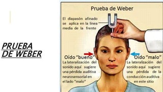 PRUEBA
DE WEBER
 
