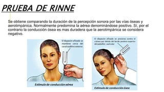 PRUEBA DE RINNE
Se obtiene comparando la duración de la percepción sonora por las vías óseas y
aerotimpánica. Normalmente predomina la aérea denominándose positivo. Sí, por el
contrario la conducción ósea es mas duradera que la aerotimpánica se considera
negativo.
 