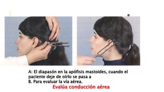 B.
A: El diapasón en la apófisis mastoides, cuando el
paciente deje de oírlo se pasa a
B. Para evaluar la vía aérea.
Evalúa conducción aérea
 
