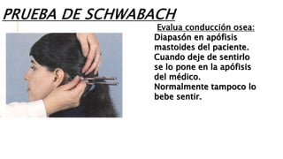 Evalua conducción osea:
Diapasón en apófisis
mastoides del paciente.
Cuando deje de sentirlo
se lo pone en la apófisis
del médico.
Normalmente tampoco lo
bebe sentir.
PRUEBA DE SCHWABACH
 