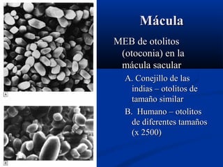 Mácula
MEB de otolitos
(otoconia) en la
mácula sacular
A. Conejillo de las
indias – otolitos de
tamaño similar
B. Humano – otolitos
de diferentes tamaños
(x 2500)

 