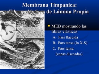 Membrana Tímpanica:
Fibras elásticas de Lámina Propia


MEB mostrando las
fibras elásticas
A. Pars flaccida
B. Pars tensa (in X-S)
C. Pars tensa
(capas disecadas)

 