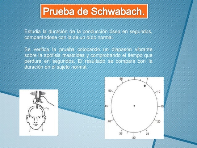 Exploración clínica de oído