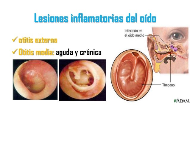 De por de que surge la psoriasis de la parte pilosa de la cabeza