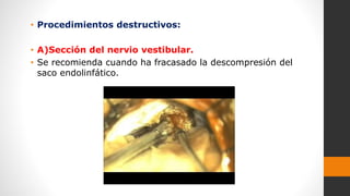 • Procedimientos destructivos:
• A)Sección del nervio vestibular.
• Se recomienda cuando ha fracasado la descompresión del
saco endolinfático.
 