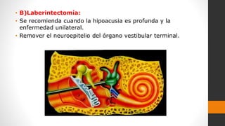 • B)Laberintectomía:
• Se recomienda cuando la hipoacusia es profunda y la
enfermedad unilateral.
• Remover el neuroepitelio del órgano vestibular terminal.
 