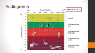Audiograma
PRESBIACUSIA
 