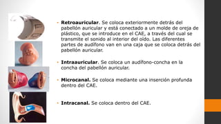 • Retroauricular. Se coloca exteriormente detrás del
pabellón auricular y está conectado a un molde de oreja de
plástico, que se introduce en el CAE, a través del cual se
transmite el sonido al interior del oído. Las diferentes
partes de audífono van en una caja que se coloca detrás del
pabellón auricular.
• Intraauricular. Se coloca un audífono-concha en la
concha del pabellón auricular.
• Microcanal. Se coloca mediante una inserción profunda
dentro del CAE.
• Intracanal. Se coloca dentro del CAE.
 