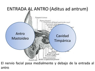 ENTRADA AL ANTRO (Aditus ad antrum)
El nervio facial pasa medialmente y debajo de la entrada al
antro.
Cavidad
Timpánica
Antro
Mastoideo
 