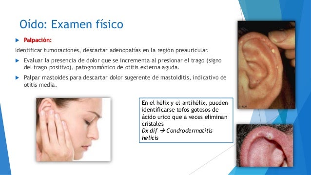 Oido semiología