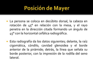  La persona se coloca en decúbito dorsal, la cabeza en
rotación de 45° en relación con la mesa, y el rayo
penetra en la dirección citada formando un ángulo de
45° con la horizontal cefálica radiográfica.
 Esta radiografía da los datos siguientes; delante, la raíz
cigomática, cóndilo, cavidad glenoidea y el borde
anterior de la pirámide; detrás, la línea que señala su
borde posterior, con la impresión de la rodilla del seno
lateral.
 