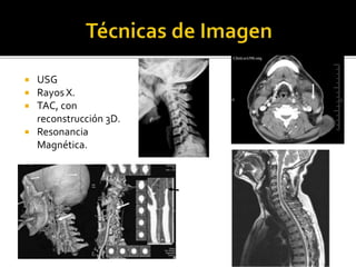  USG
 Rayos X.
 TAC, con
reconstrucción 3D.
 Resonancia
Magnética.
 