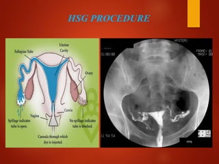 OIL CONTRAST MEDIA IN RADIOLOGY | PPTX