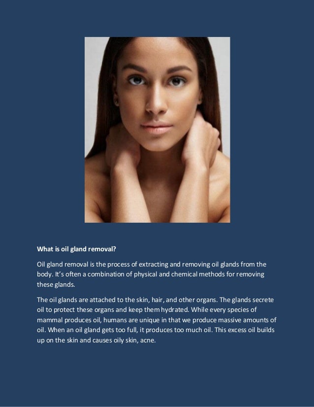 Oil Gland Removal in Singapore