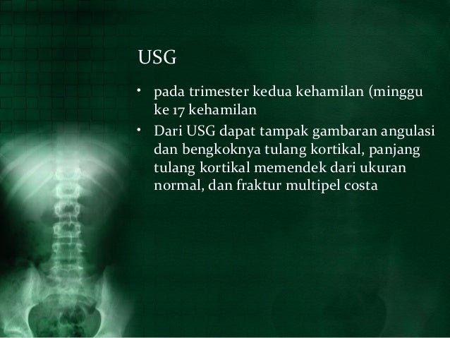 Oi nelli nur indah sari