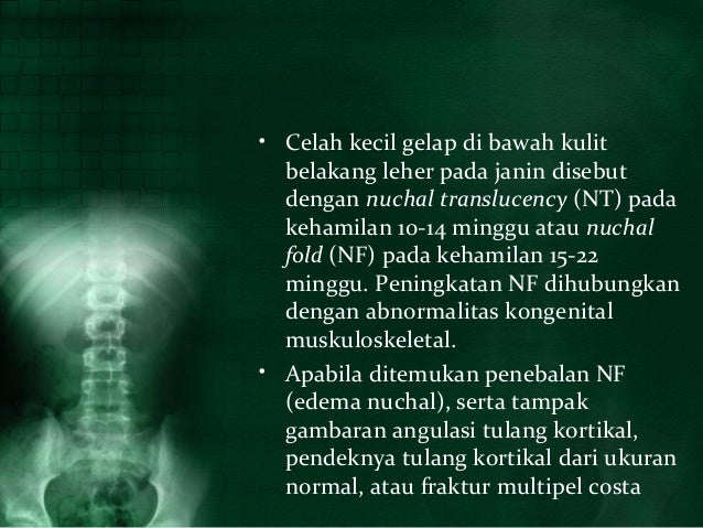 Oi nelli nur indah sari