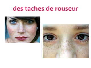 des taches de rouseur
 