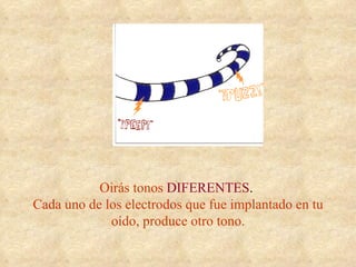 Oirás tonos   DIFERENTES .  Cada uno de los electrodos que fue implantado en tu oído, produce otro tono. 