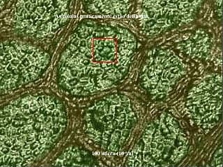 100 micra (10-4
m)
As células praticamente estão definidas.
 