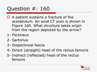 Question #: 160 A patient sustains a fracture of the acetabulum. An axial CT scan is shown in Figure 160. What structure takes origin from the region depicted by the arrow? 1- Pectineus 2- Sartorius 3- Iliopectineal fascia 4- Direct (straight) head of the rectus femoris 5- Indirect (reflected) head of the rectus femoris 