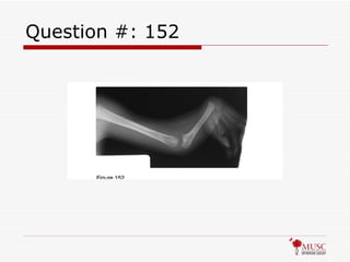 Question #: 152 
