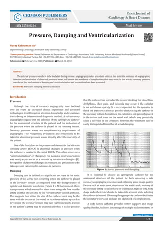 Nuray Kahraman Ay*
Department of Cardiology, Bezmialem Vakif University, Turkey
*Corresponding author: Nuray Kahraman Ay, Department of Cardiology, Bezmialem Vakif University, Adnan Menderes Boulevard (Vatan Street )
34093 Fatih/ Istanbul, Turkey; Tel: +90.5359864489; Fax: +90.212 6217580; Email:
Submission: February 16, 2018; Published: March 21, 2018
Pressure, Damping and Ventricularization
Introduction
Pressure
Although the risks of coronary angiography have declined
over the years by increased clinical experience and advanced
technologies, it still requires attention, knowledge and experience
due to being an interventional diagnostic method. A safe coronary
angiography begins with the selection of the appropriate catheter
for the anatomical structure of the patient and the evaluation of
the pressure when the catheter is placed in the coronary ostium.
Coronary pressure waves are complementary requirements of
angiography. The recognition, evaluation and precautions to be
taken for abnormal pressure waves directly affect the mortality of
the patient.
One of the first clues to the presence of stenosis in the left main
coronary artery (LMCA) is abnormal changes in pressure when
the catheter is seated in the ostial LMCA. This often occurs as a
“ventricularization” or “damping”. For decades, ventricularization
was mostly experienced as a stenosis by invasive cardiologists [1].
Recognition of abnormal changes in pressure and precautions to be
taken prevent catastrophic outcomes in patients.
Damping
Damping can be defined as a significant decrease in the aortic
pressure of the aortic root occurring when the catheter is placed
in the coronary ostium accompanied with the disappearance of
systolic and diastolic waveforms (Figure 1). At that moment, there
is no pressure which means that there is no antegrade flow into the
artery and that the area fed by the relevant artery cannot get blood.
This suggests that either the size of the catheter used may be the
same with the ostium of the vessel, or a catheter-related spasm has
developed. The coronary ostium may have narrowed due to a lesion
or the patient’s artery may be anatomically thin. It is also possible
that the catheter has occluded the vessel, blocking the blood flow.
Arrhythmia, chest pain, and ischemia may occur if the catheter
is not withdrawn quickly. It is very important for the operator to
check the pressure as soon as possible after placing the catheter in
the coronary ostium. Sometimes, the catheter is not properly placed
in the ostium and leans on the vessel wall, which may potentially
cause a decrease in the pressure. However, the waveform can be
easily distinguished from that of actual damping.
Figure 1: Aortic pressure and damping.
It is essential to choose an appropriate catheter for the
anatomical structure of the patient for both ensuring a safe
coronary angiography procedure and obtaining good image quality.
Factors such as aortic root, structure of the aortic arch, anatomy of
the coronary artery (transfemoral or transradial; right or left), body
shape and catheter aid should be taken into account while selecting
thecathetertobeused.Choosingtheappropriatecatheterfacilitates
the operator’s work and reduces the likelihood of complications.
A wide lumen catheter provides better support and image
quality. Besides, it allows the passage of multiple balloons/stents or
Mini Review
Open Journal of
Cardiology & Heart DiseasesC CRIMSON PUBLISHERS
Wings to the Research
1/3Copyright © All rights are reserved by Nuray Kahraman Ay
Volume 1 - Issue - 4
Abstract
The arterial pressure waveform to be included during coronary angiography makes procedure safer. At this point the sentience of angiographer,
detection and evaluation of abnormal pressure waves, will ensure the avoidance of complications that may occur. In this article, coronary pressure
waveforms, the mechanisms of damping and ventricularization and precautions have been presented.
Keywords: Pressure; Damping; Ventricularization
ISSN 2578-0204
 