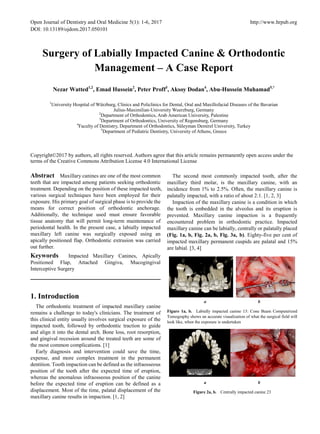 Open Journal of Dentistry and Oral Medicine 5(1): 1-6, 2017 http://www.hrpub.org
DOI: 10.13189/ojdom.2017.050101
Surgery of Labially Impacted Canine & Orthodontic
Management – A Case Report
Nezar Watted1,2
, Emad Hussein2
, Peter Proff3
, Aksoy Dodan4
, Abu-Hussein Muhamad5,*
1
University Hospital of Würzburg, Clinics and Policlinics for Dental, Oral and Maxillofacial Diseases of the Bavarian
Julius-Maximilian-University Wuerzburg, Germany
2
Department of Orthodontics, Arab American University, Palestine
3
Department of Orthodontics, University of Regensburg, Germany
4
Faculty of Dentistry, Department of Orthodontics, Süleyman Demirel University, Turkey
5
Department of Pediatric Dentistry, University of Athens, Greece
Copyright©2017 by authors, all rights reserved. Authors agree that this article remains permanently open access under the
terms of the Creative Commons Attribution License 4.0 International License
Abstract Maxillary canines are one of the most common
teeth that are impacted among patients seeking orthodontic
treatment. Depending on the position of these impacted teeth,
various surgical techniques have been employed for their
exposure. His primary goal of surgical phase is to provide the
means for correct position of orthodontic anchorage.
Additionally, the technique used must ensure favorable
tissue anatomy that will permit long-term maintenance of
periodontal health. In the present case, a labially impacted
maxillary left canine was surgically exposed using an
apically positioned flap. Orthodontic extrusion was carried
out further.
Keywords Impacted Maxillary Canines, Apically
Positioned Flap, Attached Gingiva, Mucogingival
Interceptive Surgery
1. Introduction
The orthodontic treatment of impacted maxillary canine
remains a challenge to today's clinicians. The treatment of
this clinical entity usually involves surgical exposure of the
impacted tooth, followed by orthodontic traction to guide
and align it into the dental arch. Bone loss, root resorption,
and gingival recession around the treated teeth are some of
the most common complications. [1]
Early diagnosis and intervention could save the time,
expense, and more complex treatment in the permanent
dentition. Tooth impaction can be defined as the infraosseous
position of the tooth after the expected time of eruption,
whereas the anomalous infraosseous position of the canine
before the expected time of eruption can be defined as a
displacement. Most of the time, palatal displacement of the
maxillary canine results in impaction. [1, 2]
The second most commonly impacted tooth, after the
maxillary third molar, is the maxillary canine, with an
incidence from 1% to 2.5%. Often, the maxillary canine is
palatally impacted, with a ratio of about 2:1. [1, 2, 3]
Impaction of the maxillary canine is a condition in which
the tooth is embedded in the alveolus and its eruption is
prevented. Maxillary canine impaction is a frequently
encountered problem in orthodontic practice. Impacted
maxillary canine can be labially, centrally or palatally placed
(Fig. 1a, b, Fig. 2a, b, Fig. 3a, b). Eighty-five per cent of
impacted maxillary permanent cuspids are palatal and 15%
are labial. [3, 4]
a b
Figure 1a, b. Labially impacted canine 13: Cone Beam Computerized
Tomography shows an accurate visualization of what the surgical field will
look like, when the exposure is undertaken
a b
Figure 2a, b. Centrally impacted canine 23
 