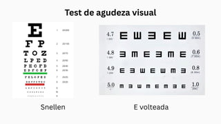 Test de agudeza visual
Snellen E volteada
 