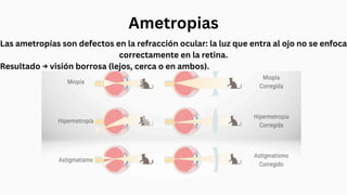 Ametropias
Las ametropías son defectos en la refracción ocular: la luz que entra al ojo no se enfoca
correctamente en la retina.
Resultado → visión borrosa (lejos, cerca o en ambos).
 