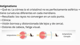 Astigmatismo
• Qué es: La córnea (o el cristalino) no es perfectamente esférica →
tiene curvaturas diferentes en cada meridiano.
• Resultado: los rayos no convergen en un solo punto.
• Clínica:
• Visión borrosa y distorsionada (de lejos y de cerca).
• Dolores de cabeza, fatiga visual.
 