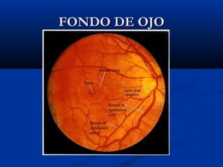 FONDO DE OJO

 